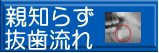 親知らず 抜歯流れ